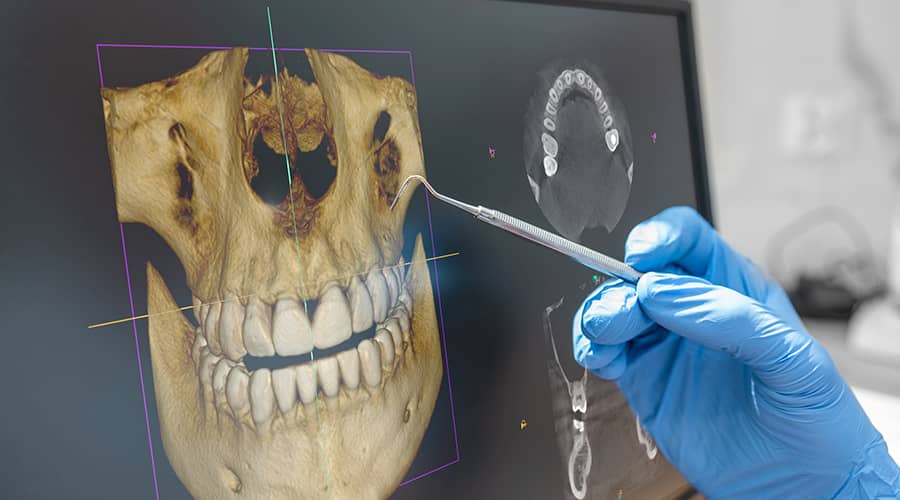 Dental professional reviewing a 3D CBCT scan of a patient's teeth and jaw